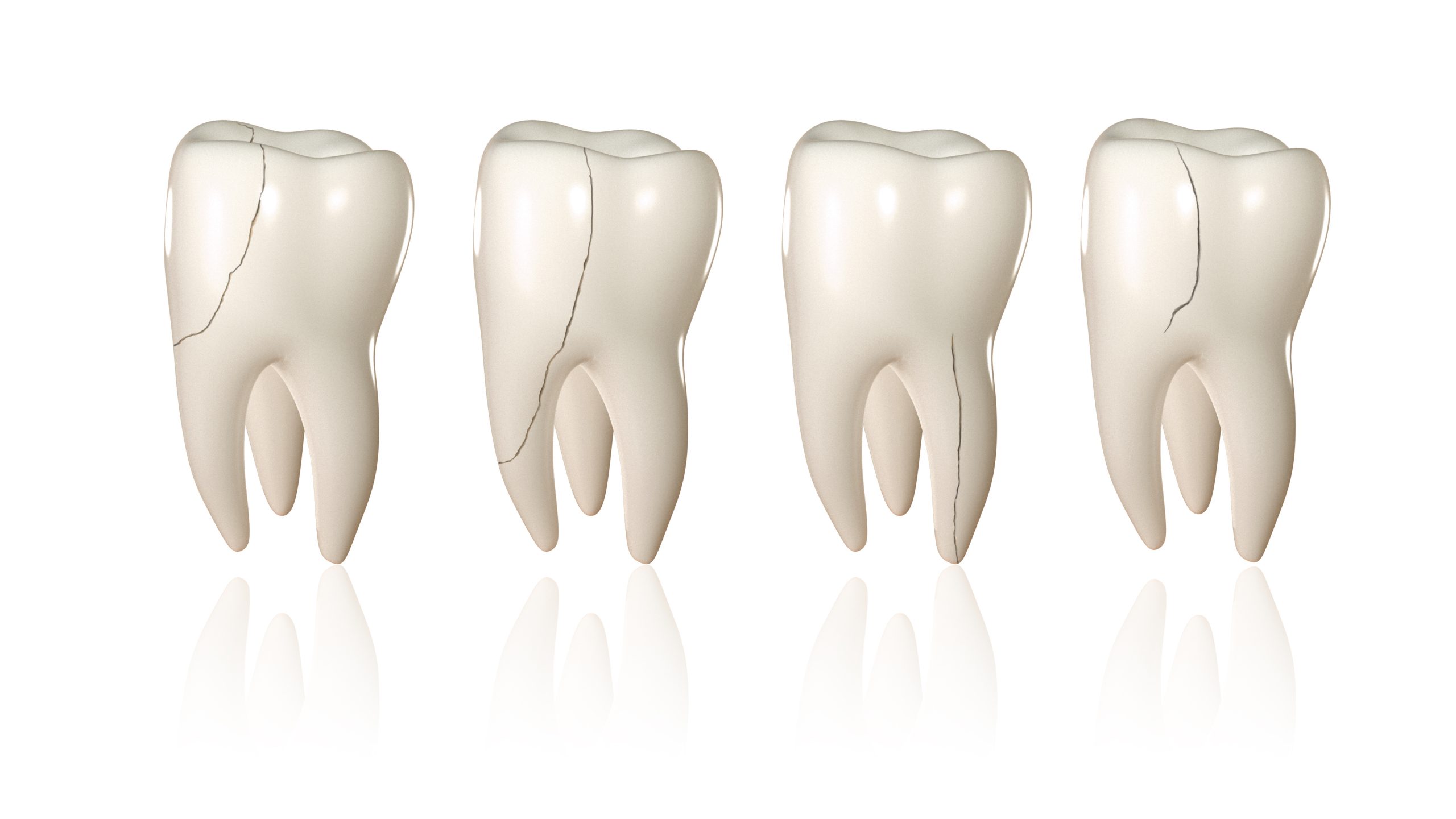 cracked teeth Dunmore